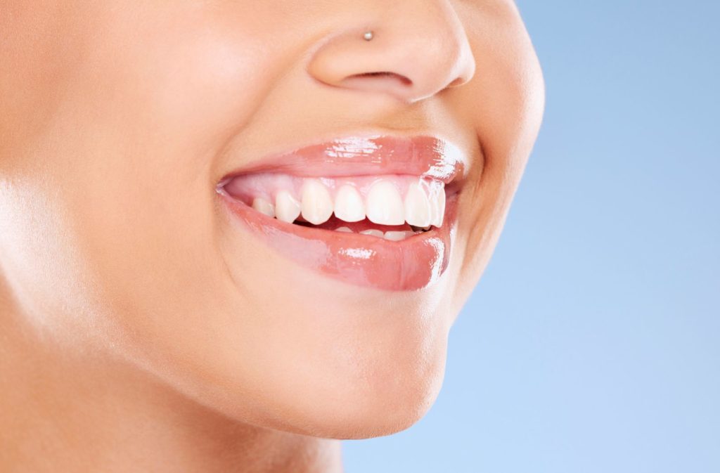 How to Prepare for Teeth Whitening: Tips from Your Cosmetic Dentist Sloan Dental