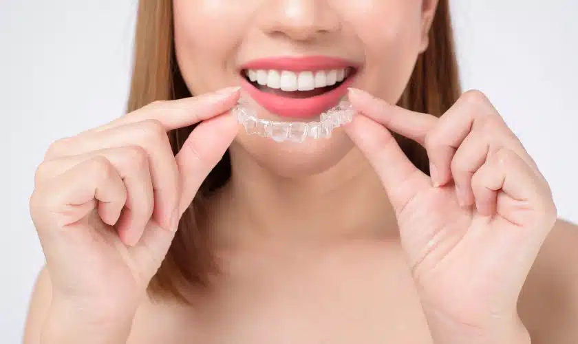 13 Things You Need to Know Before Getting Invisalign in Glasgow Sloan Dental