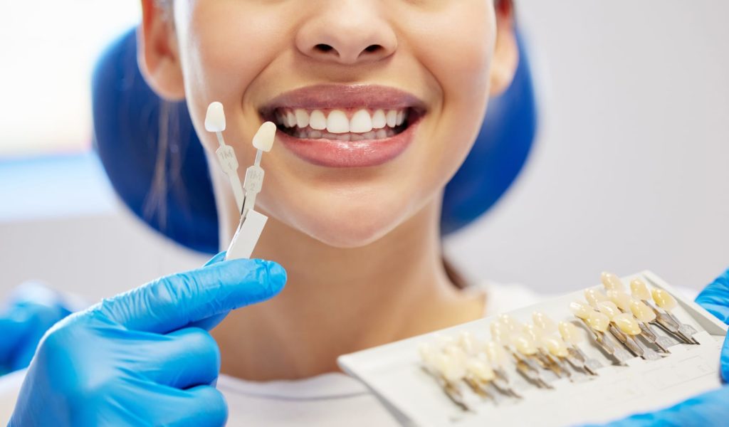 How to Prepare for Teeth Whitening: Tips from Your Cosmetic Dentist Sloan Dental