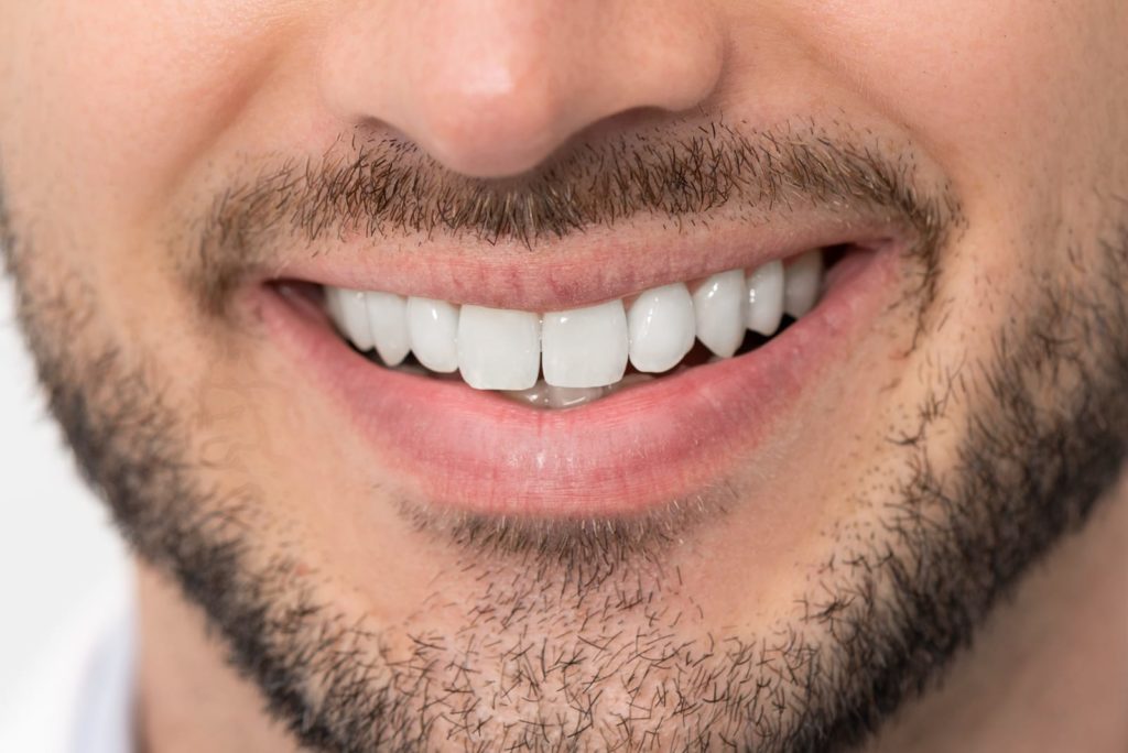 Composite Bonding in Glasgow: All You Need to Know Before Getting It Sloan Dental