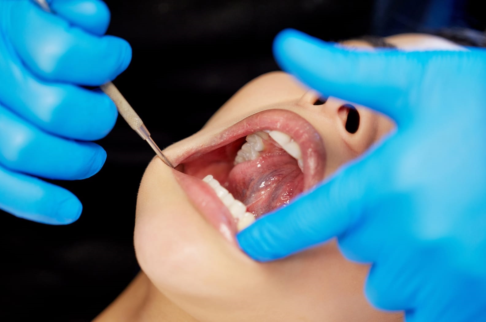 7 Common Dental Issues That Composite Bonding Can Fix Sloan Dental